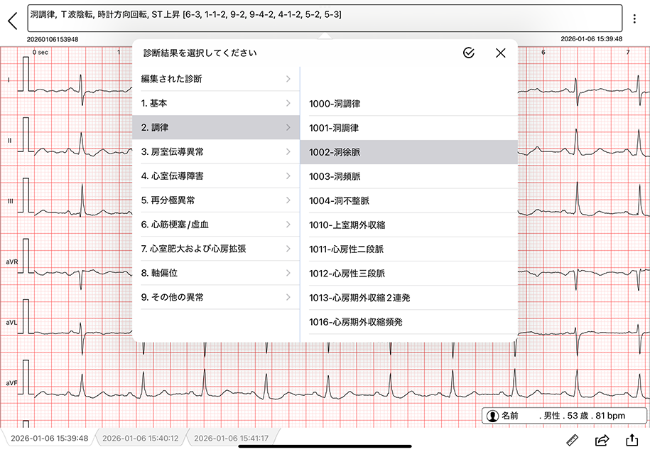 診断を支援する自動解析